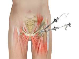 arthroscopy of hip and knee